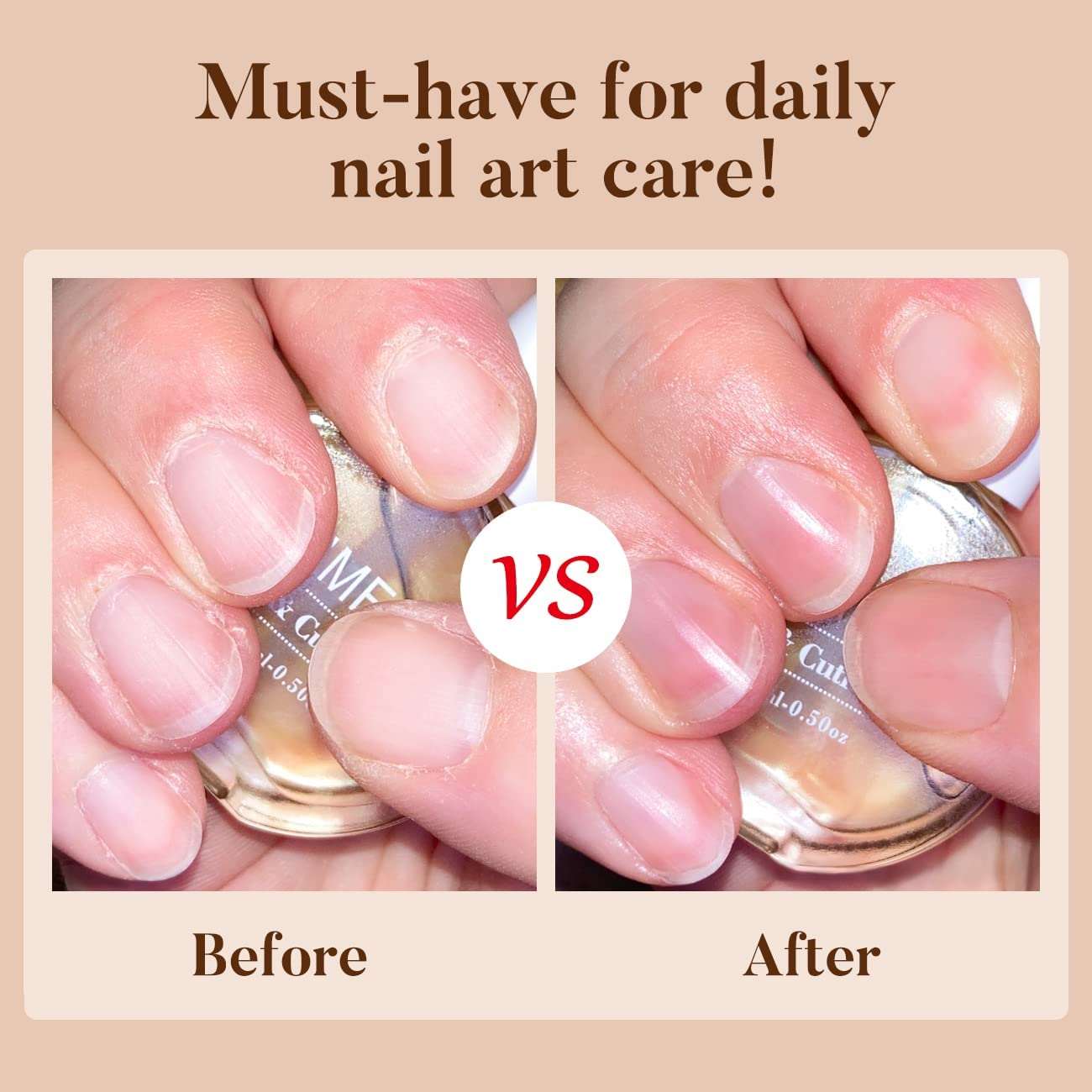 what does cuticle oil do